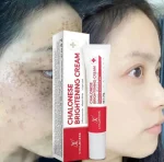 Chalose Brightening Cream 20ml Whitening All Skin Types