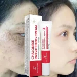 Chalose Brightening Cream 20ml Whitening All Skin Types