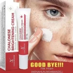 Chalose Brightening Cream 20ml Whitening All Skin Types - Image 3
