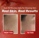 Chalose Brightening Cream 20ml Whitening All Skin Types - Image 4