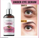 Under Eye Serum Dark Spot Removal 14 Days - Image 3