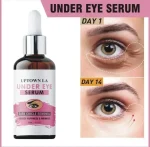 Under Eye Serum Dark Spot Removal 14 Days - Image 5