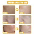White Rice Serum 50ml Skin Brightening Acne Marks Removal - Image 3