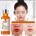 Vitamin C Serum for Acne Marks & Brightening - Image 3