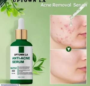 Uptown Anti-Acne Serum 20% B3 for Acne Removal