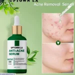 Uptown Anti-Acne Serum 20% B3 Face Serum