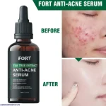 Fort Tea Tree Anti-Acne Serum 30ml Face Treatment
