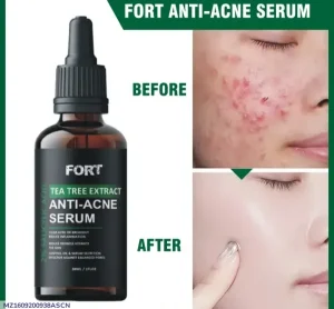 Fort Tea Tree Anti-Acne Serum 30ml Face Treatment