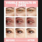 Uptown LA Dark Circles Eye Cream 30ml – Brightening Night Use Formula - Image 4