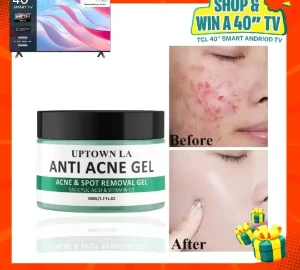 Uptown LA Anti Acne Gel 50ml Oil Control - Image 3