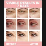 Dark Circles Eye Gel Cream 10ml Whitening - Image 5