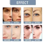 Fort Under Eye Dark Circle Removal Gel 30% - Image 3