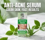 Anti-Acne Serum with Salicylic Acid 30ml Oil - Image 3