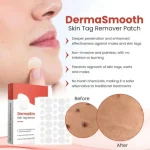 DermaSmooth Skin Tag Remover Patch - Image 5