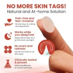 DermaSmooth Skin Tag Remover Patch - Image 6