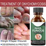 All Natural Nail Fungus Treatment for Home & Office - Image 4