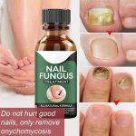 All Natural Nail Fungus Treatment for Home & Office - Image 6