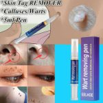 Warts Remover Original Cream Wart Removal Ointment Wart Treatment Skin Tag Mole Remover Antibacterial Foot Wart - Image 3
