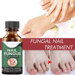 Fast Nail Fungal Treatments Nail Repair Essences Serum Care Treatments Foot Nail Fungus Removal Gel Paronychia Onychomycosis - Image 3