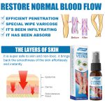 30ml Varicose Veins Treatment Spray Varicose Vein Treatment Cream Repair Varicocele Removal Pain Relief Kidney Inflammation Legs Vein Health Care Spray