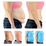 Tummy Tuck Miracle Slimming System Kit - Image 2