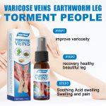 30ml Varicose Veins Treatment Spray Varicose Vein Treatment Cream Repair Varicocele Removal Pain Relief Kidney Inflammation Legs Vein Health Care Spray - Image 3