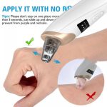 Electric Suction Blackhead Instrument Home Beauty Instrument Blackhead Pore Cleaning. - Image 5