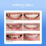 Snap On Smile - Veneers Teeth for Men and Women - Moldable False Artificial Braces Teeth - Image 4