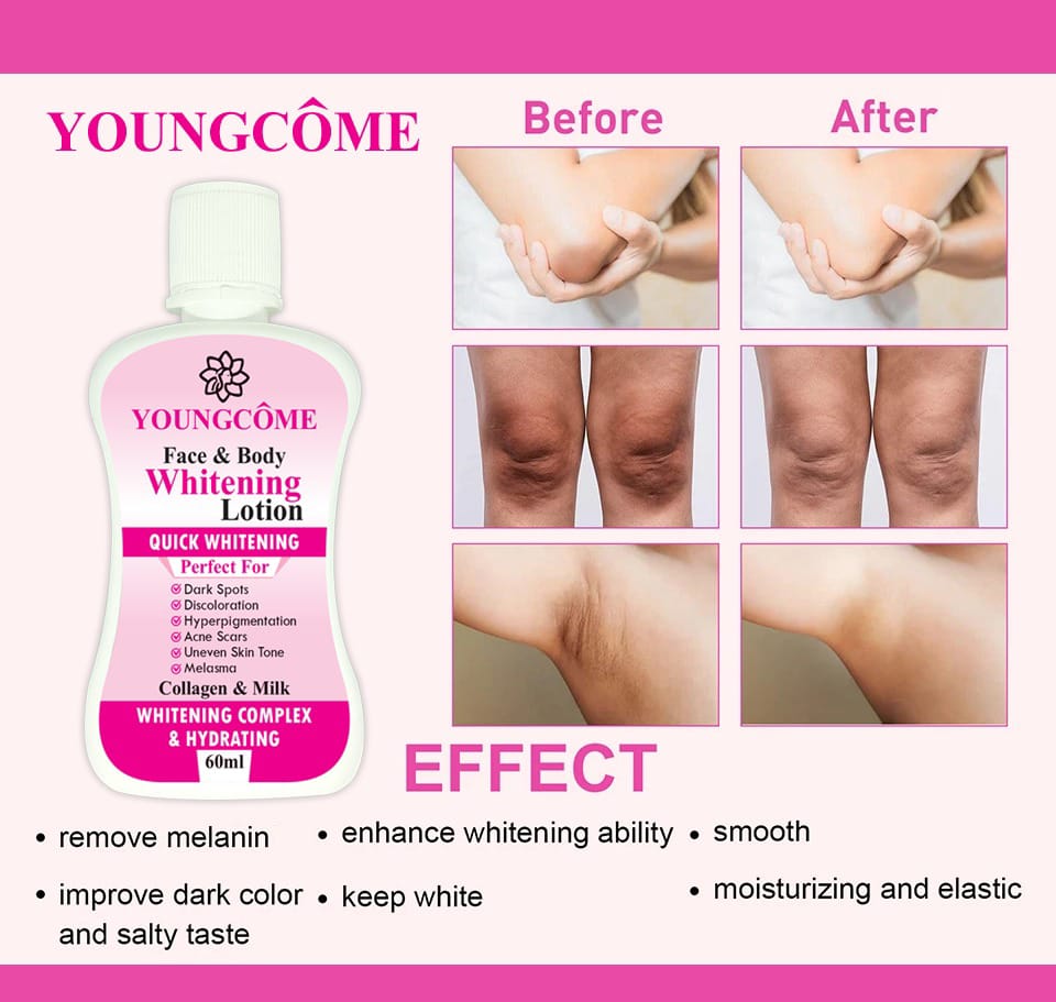 63d308d6-3a0e-4758-897c-455d56b084e4.jpeg YOUNGCOME 60ml Face Body Whitening Lotion Underarm Brightening Private Underarm Body Cream Legs Whitening Parts - Image 1