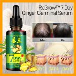 7 Day Ginger Germinal Oil Hair Nutrient Solution Hair Growth Essence Liquid Fast Natural Hair Loss Treatment Hair Care (30ml) - Image 2