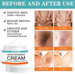 Pack Of 2 | Sensitive Area Whitening Cream for Private Parts, Underarms, Inner Thighs, and Dark Spot Lightening -30ml - Image 4