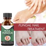 Fast Nail Fungal Treatments Nail Repair Essences Serum Care Treatments Foot Nail Fungus Removal Gel - Image 2