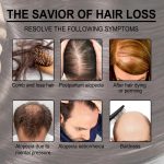 30ml Rosemary Hair Care Essential Oil Anti Hair Loss Growth Essential Oil Hair Care Nourishing Scalp Essential Oil - Image 4