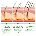 30ml Rosemary Hair Care Essential Oil Anti Hair Loss Growth Essential Oil Hair Care Nourishing Scalp Essential Oil - Image 3