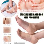 Half Heel Pain Anti-Crack Silicone Set â€“ Unisex Anti-Crack Pain Relief - 01 Pair