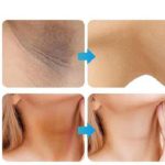 Whitening Cream for sensitive Areas underarm and private Areas - 30g