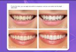 teeth brightening hismiles V34 Colour Corrector Serum 30ml - Image 4