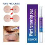 Warts Remover Original Cream Wart Removal Ointment Wart Treatment Skin Tag Mole Remover Antibacterial Foot Wart - Image 2