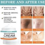 Premium Whitening Cream for Underarms & Sensitive Areas – Brightening & Moisturizing Skin Care