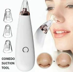 Blackhead Remover 50ml – Deep Pore Cleansing & Blackhead Removal Facial Treatment (Copy) - Image 2
