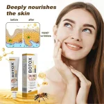 Acne Scar Removal Cream 30ml – Dark Spot & Acne Mark Treatment for All Skin Types