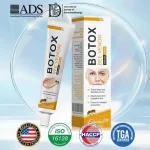 Acne Scar Removal Cream 30ml – Dark Spot & Acne Mark Treatment for All Skin Types - Image 2