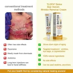 Acne Scar Removal Cream 30ml – Dark Spot & Acne Mark Treatment for All Skin Types - Image 3